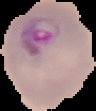 malaria cell image