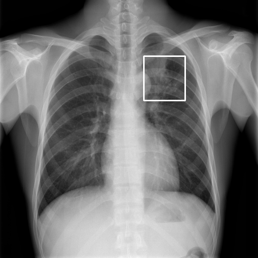 chest x-ray image